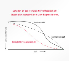 Diagramm-Visualisierung mit Achsen und Graphen, um Schäden an retinaler Nervenfaserschicht zu veranschaulichen