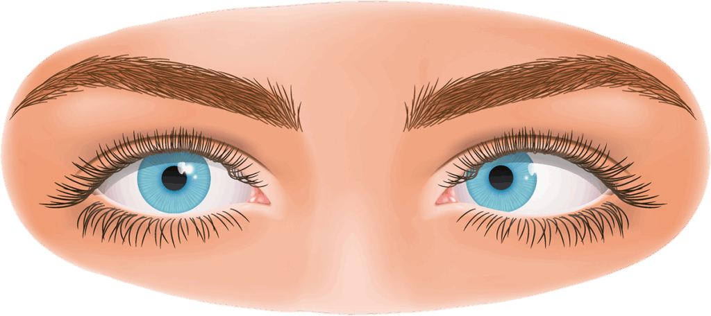 Ein Auge des Gesichts schielt nach innen